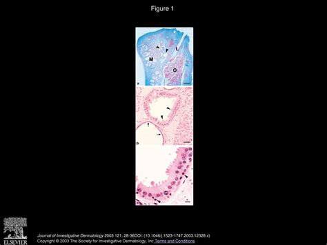 Human Glands Of Moll Histochemical And Ultrastructural