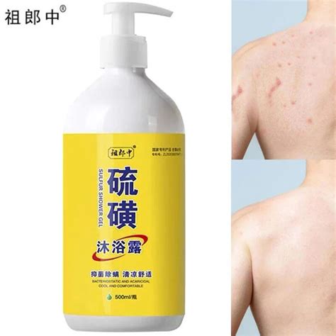 Sulfur Ointment Scabies Mites Fat Body Wash Lotion Bath Skin Care