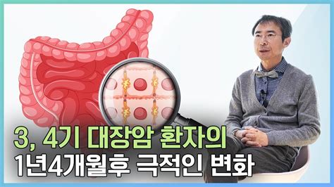 대장암4기 직장암3기 극복한 4분의 극적인 사례를 만납니다 간 림프절 전이 대장암 4기 5결장 폐까지 전이된 환자