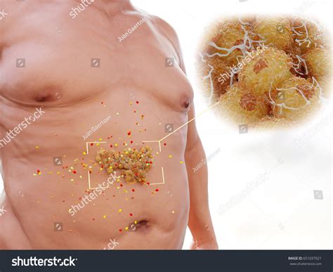 39 Adipose Tissue Estrogen Images Stock Photos Vectors Shutterstock