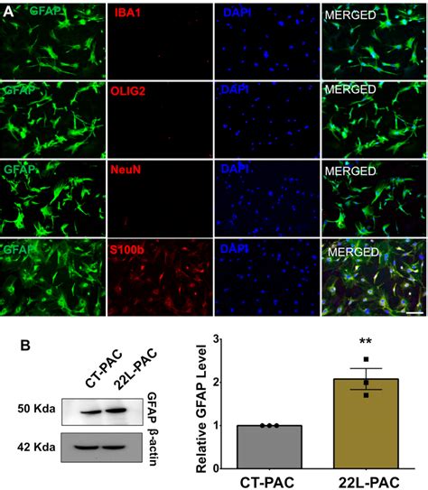 Figure 2 From Phagocytic Activities Of Reactive Microglia And