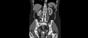 Ct Bauch Praxis F R Radiologische Diagnostik Hanau