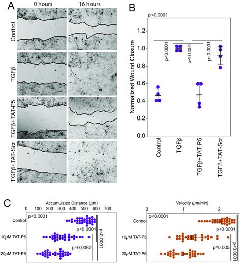 Tat P5 Inhibits Rpe And Mda Mb 231 Cancer Cell Migration Ab Rpe