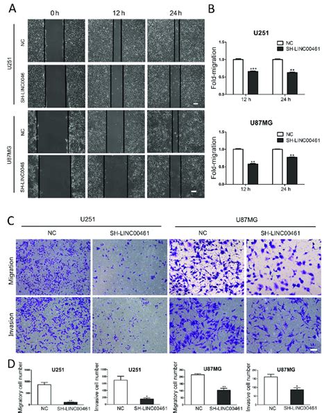 Down Regulation Of Linc00461 Inhibited Cell Migration And Invasion A Download Scientific