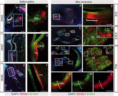 Spatiotemporal Expression Patterns Of SOX2 And B RAF During Vertebrate