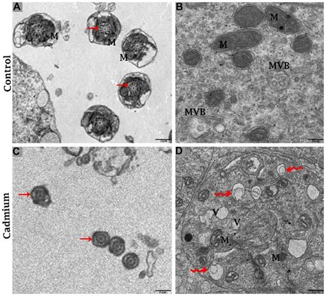 Electron Micrograph Of Ultrastructures Of Mid Peace Of Spermatozoa And