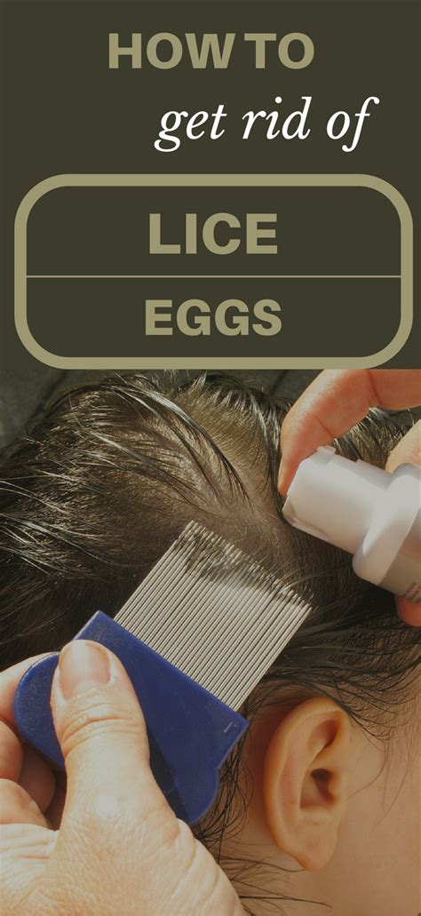 How To Get Rid Of Lice Eggs TopCleaningTips Lice Eggs Louse