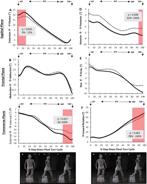 Figure 2 From Hip And Pelvis Movement Patterns In Patients With