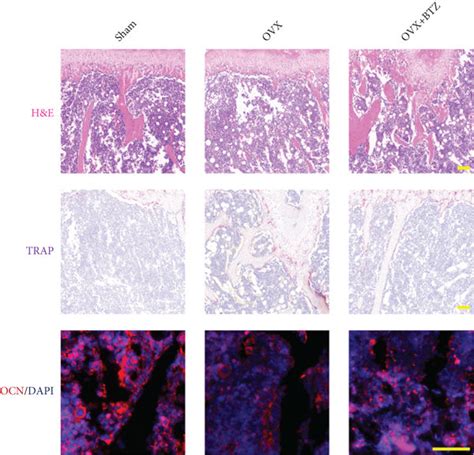 The Effect Of Bortezomib On The Histological Bone Loss In OVX Mice A