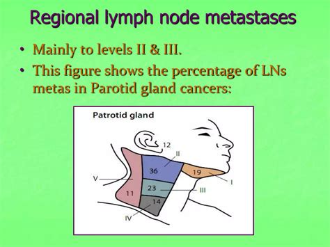 Salivary Glands Cancer Ppt