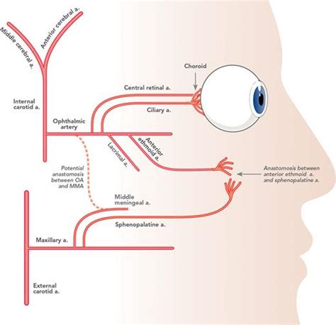 Anesthesia For Ophthalmic Artery Chemosurgery Anesthesiology