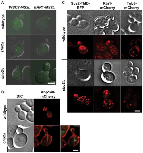 Deletion Of Cho Affects Mrna Localization And Cer Morphology But Not