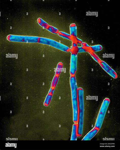 Anthrax Bacteria Coloured Transmission Electron Micrograph Tem Of