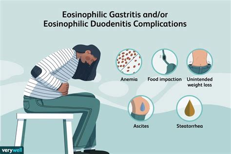 Eosinophilic Gastritis and/or Eosinophilic Duodenitis: Causes, Symptoms ...