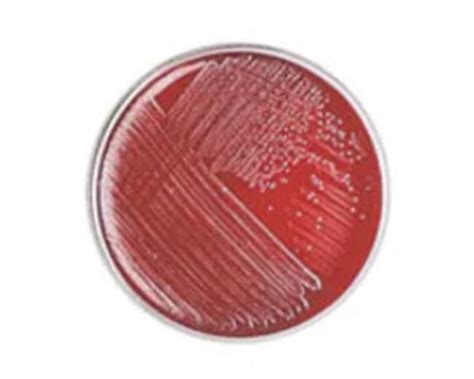 Thermo Scientific Phenylethyl Alcohol Agar With 5 Sheep Blood