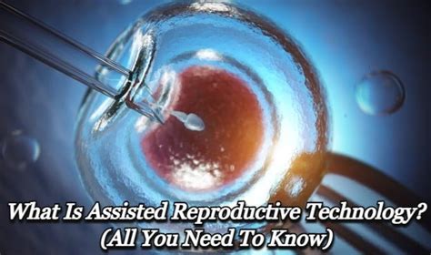 What Is Assisted Reproductive Technology All You Need To Know