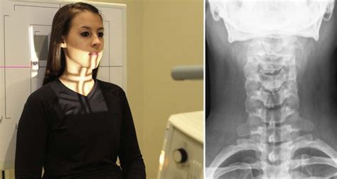 Radiographic Positioning Radiology Key