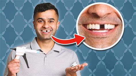 Does Invisalign Work If I’m Missing A Tooth Yes Here S How Youtube