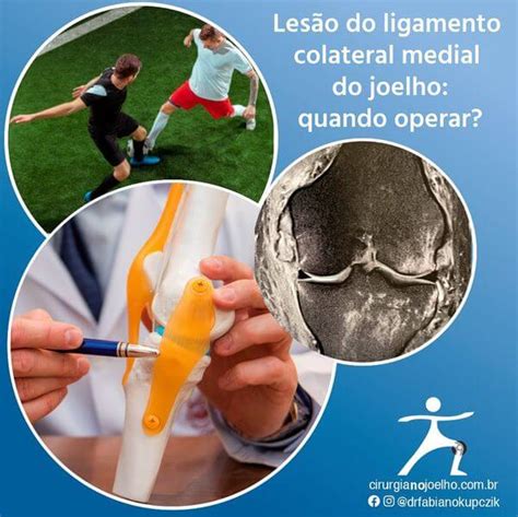 Lesão Do Ligamento Colateral Medial Do Joelho Quando Operar Dr Fabiano Kupczik