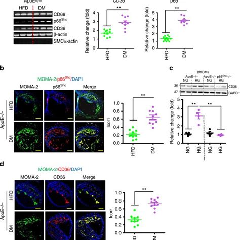 P66shc And Cd36 Expressions Are Increased In Plaque Associated Download Scientific Diagram