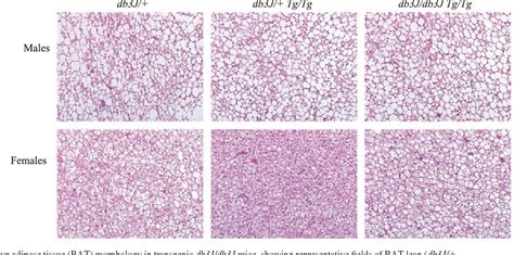 Figure 1 from Transgenic complementation of leptin receptor deficiency. II. Increased leptin ...