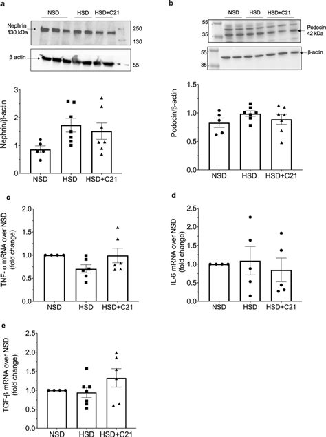 Representative Western Blots Of Expression Of Glomerular Injury Markers