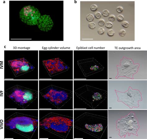 A A Representative Immunofluorescence Image Of Blastocyst Cell Number Download Scientific