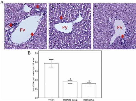 A Comparison Of Intrahepatic Bile Duct Between Groups B