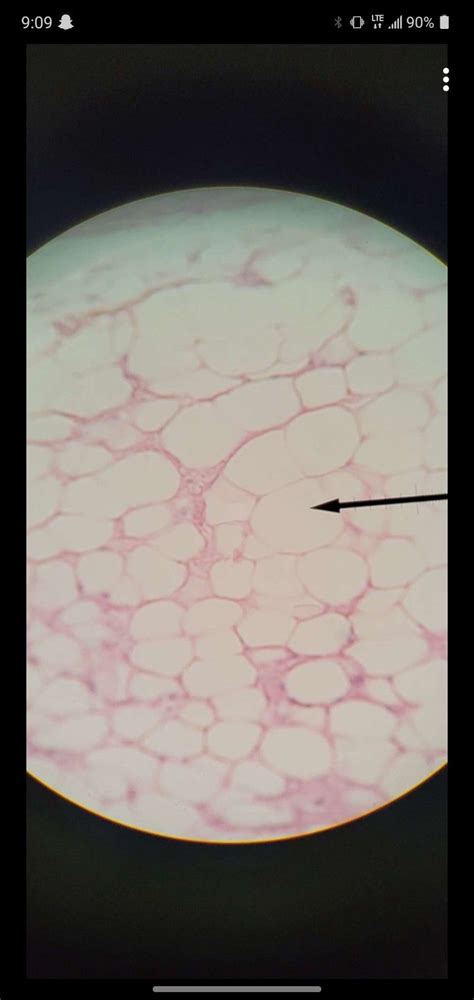 Adipose Connective Tissue | Adipose tissue, Adipose, Tissue