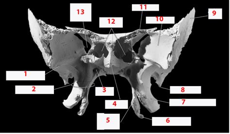 Sphenoid Anterior Diagram Quizlet