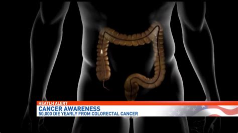 Colon Cancer Screening Can Save Your Life Wear