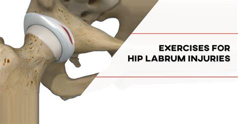 Exercises For Hip Labrum Injuries [p]rehab