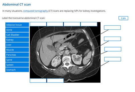 Solved Abdominal Ct Scan In Many Situations Computed