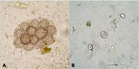 A Egg Packet Of Dipylidium Caninum Each Egg Is Approximately 35 60 µm