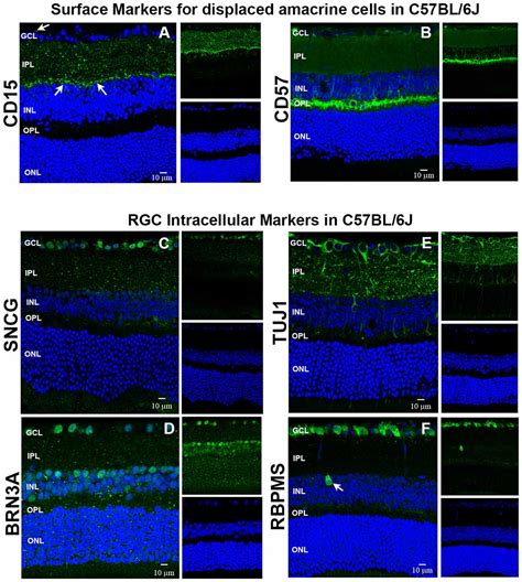 Frontiers Isolation And Molecular Profiling Of Primary Mouse Retinal