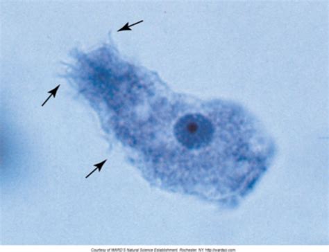 Parasite Id Pictures Flashcards Quizlet