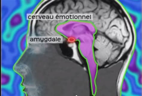 Amygdale Comment D Passer Vos Blocages Motionnels