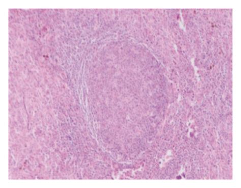 Lymph Node Biopsy Hande Stain Low Power View A Paracortical T Zone