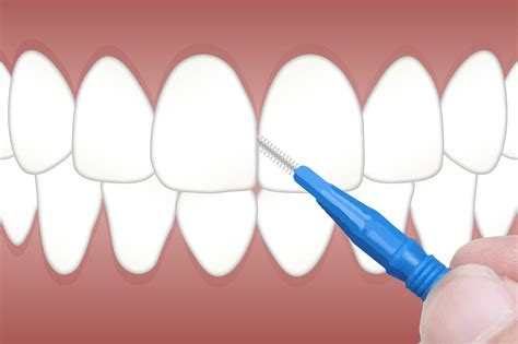 How To Choose The Best Interdental Brush Dental Care Club