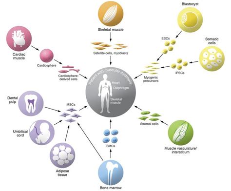 JCI Stem Cell Therapy For Muscular Dystrophies