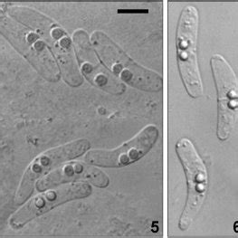 Fresh Spores Of Ceratomyxa Ghaffari N Sp From The Gallbladder Of