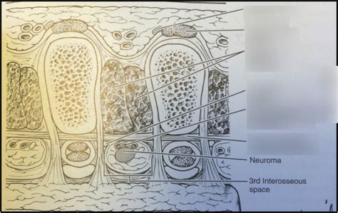 Metatarsals Cross Section Diagram Quizlet