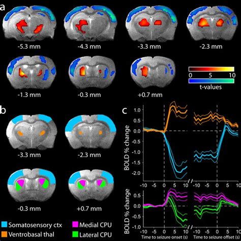 Bold Fmri Signals Associated With Swds In Gaers Resemble Human Absence