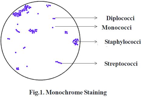 Simple Staining Principle Procedure Results And Application