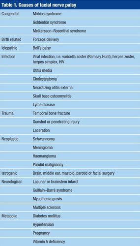 Facial palsy causes – Telegraph