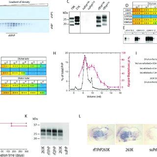 Different Patterns Of Prp Res Deposition In Brain Tissue Of