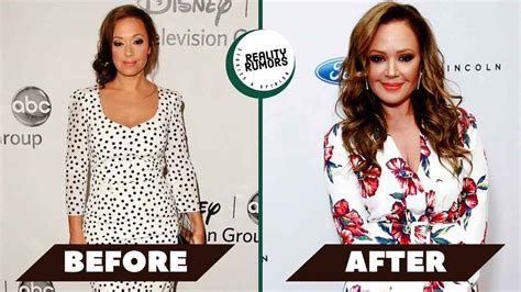 Did Leah Remini Get Plastic Surgery Including Botox A