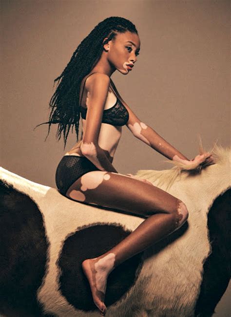 La Increíble Historia De Winnie Harlow La Modelo Que Reivindicó El Vitiligo Infobae