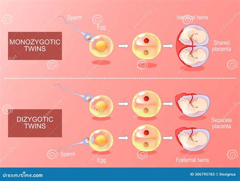 Zygote Developments In Monozygotic And Dizygotic Twins Stock Vector