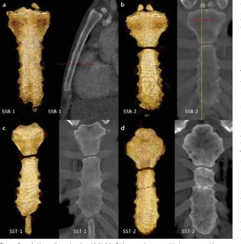 Figure 3 From Evaluation Of The Postnatal Development Of The Sternum